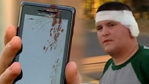 Hurt Boy with Exploding Cell Phone Defective & Dangerous Products