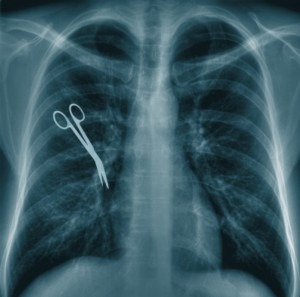 Objects Left Inside the Body Following Surgery
