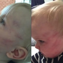 Dakota Boggess Daycare Abuse