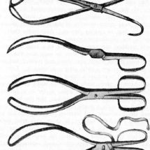 Forceps Delivery Medical Malpractice