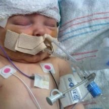 Baby Olivia Coats Birth Injury