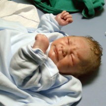Newborn Bone Fractures