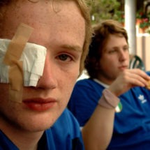 Eye Injuries, Vision Loss and Blindness