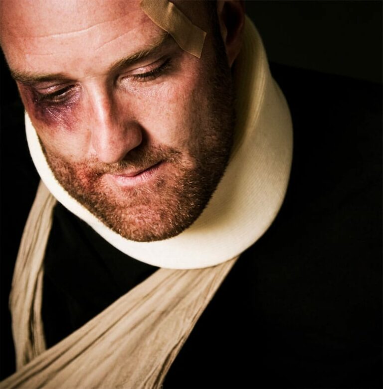 How the Eggshell Skull Rule Applies to Personal Injury Cases