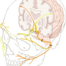 Cranial Nerve Brain Injury Attorney