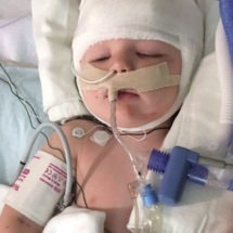 Kastyn Tyler Latham Injured at Daycare