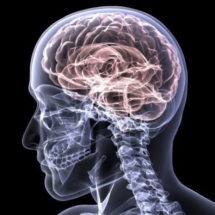Dallas Anoxic Brain Injury Lawyer