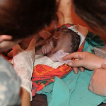 Meconium Aspiration Syndrome Birth Injuries