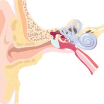 Dallas Hearing Loss Deafness Lawyer